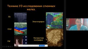 Ультразвуковая диагностика заболеваний слюнных желез  Часть 3 2021 11 26 at 04 08 GMT 8