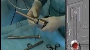 Работа морцеллятора