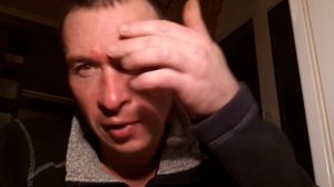 Электросварка без маски!!!ПОСЛЕДСТВИЯ!Совет начинающим сварщикам!