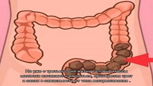 О чем свидетельствует запах кала у ребенка