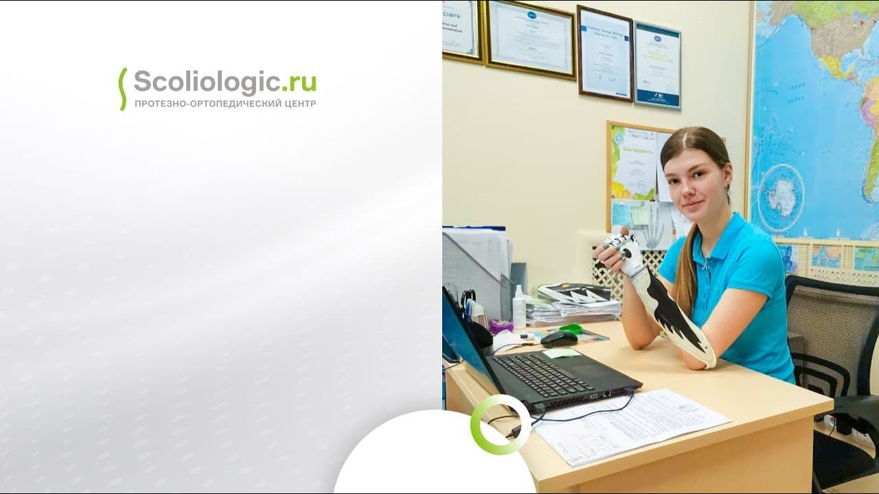 Кристина, ее работа и бионический протез