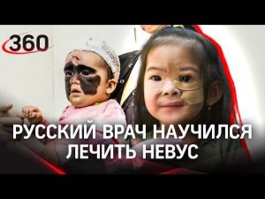 Из России – без «маски Бэтмена». Американской девочке сделали уникальную операцию в Краснодаре