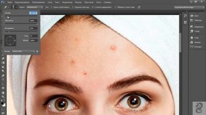 Как убрать прыщи в Photoshop