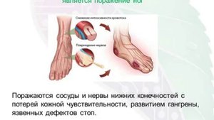 Осложнения сахарного диабета