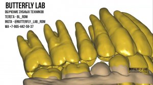 как я смоделировать цифровой дизайн в Exocad modelling wax up