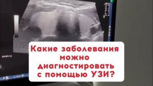 Какие заболевания можно диагностировать с помощью УЗИ?Запись в ватсап + 7 931 244 00 44