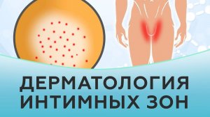 Высыпания в интимных местах. Дерматологические проблемы.