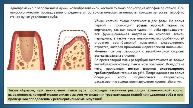 Процесс Заживления После Удаления Зуба Фото