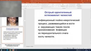 4 курс  ИПМ  Лекция№ 2  Воспалительные заболевания ЧЛО  Лектор доцент Беланов Г Н