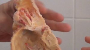 Тройничный нерв препарат