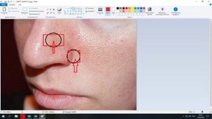 А.Шутов . Пситеррор , издевательства над моим телом.