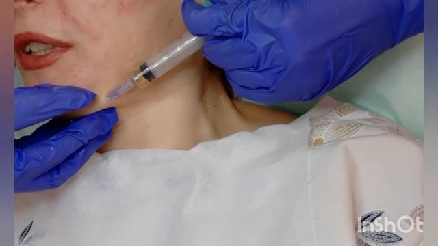 Лифтинг и омоложение ???БИО И МЕЗА ТЕРАПИИ // СБОРНИК ПРОЦЕДУР. ?????????? смотреть онлайн