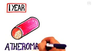 День отказа от курения, как бросить курить | Давайте разбираться