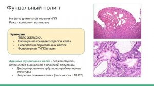 Полипы желудка | Патология