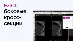 Возможности программы Ez3D: боковые кросс-секции