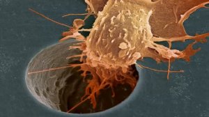 ЭХИНАЦЕЮ НЕ НАПРАСНО НАЗЫВАЮТ "ЧИСТИЛЬЩИКОМ КРОВИ." Лечебные свойства эхинацеи.