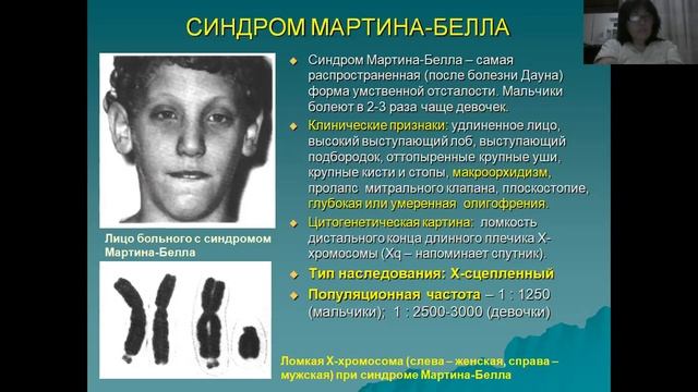 Хромосомные заболевания