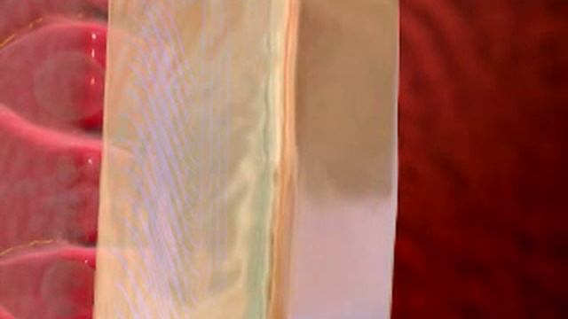 357 Муколитики смотреть онлайн