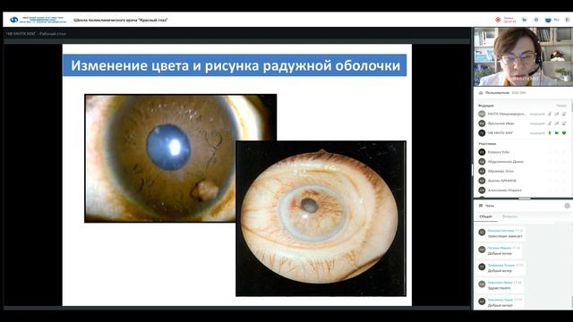 Школа поликлинического врача 10 03 2022 Красный глаз смотреть онлайн