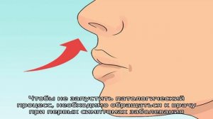 Что такое киста Торнвальда?