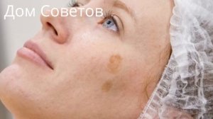 Как быстро избавиться от Пигментных Пятен при помощи Копеечных Средств