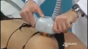 Аппарат для вакуумного массажа Deros Triworks