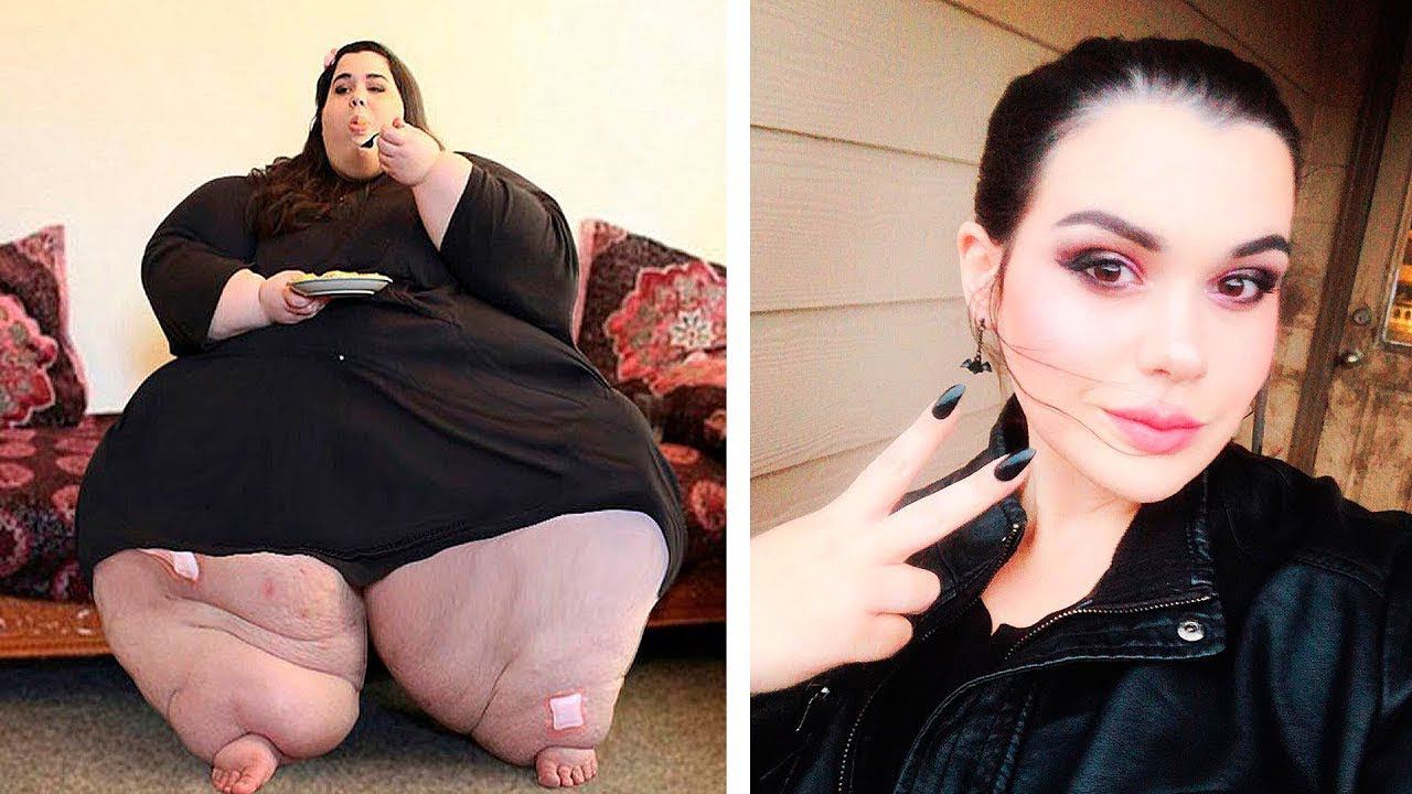 Самые Толстые Люди, Которые Сбросили Сотни Килограммов