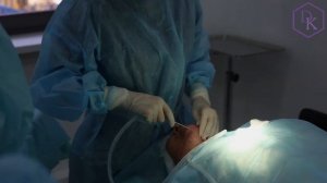 Липосакция подбородка