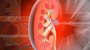 Буйракдаги Тузлардан 100 % Халос Булишни Истайсизми ???