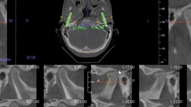 Современная диагностика в ортодонтии: часть 1 смотреть онлайн