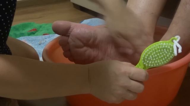 Перекись от мозолей и натоптышей. смотреть онлайн