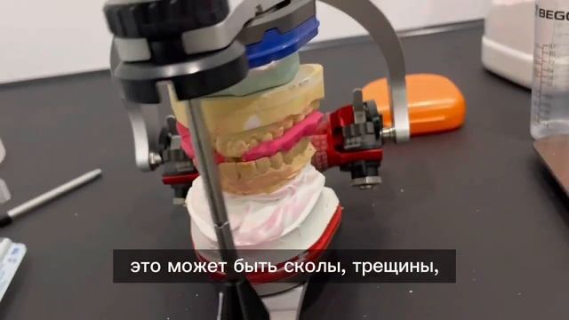Стоматолог-ортопед рассказывает о своей работе. В чем ОСОБЕННОСТИ работы стоматологом? смотреть онлайн