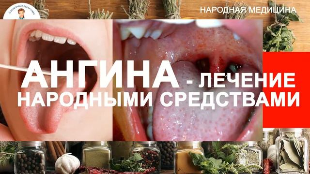 Евдокименко ангина