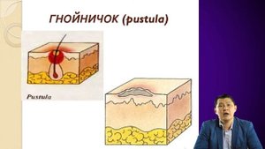 Морфологические элементы кожной сыпи
