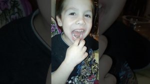 Шатается молочный зуб