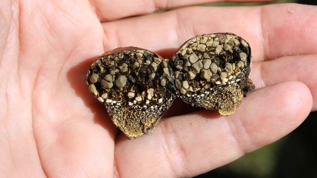 КАМНИ В ЖЕЛЧНОМ ПУЗЫРЕ | Почему появляются камни в желчном пузыре и как от них избавиться смотреть онлайн