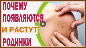 ПОЧЕМУ ПОЯВЛЯЮТСЯ И РАСТУТ РОДИНКИ.mp4
