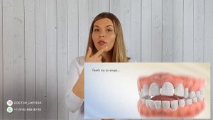 Зубы разъехались после брекетов? Ретейнеры, капы.