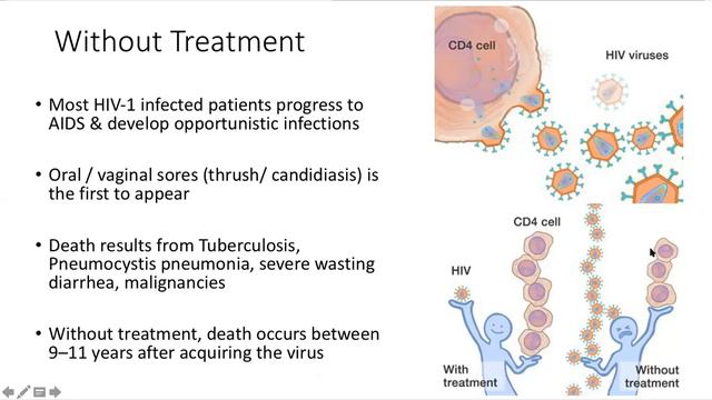 Secondary immunodeficiencies and AIDS2 смотреть онлайн