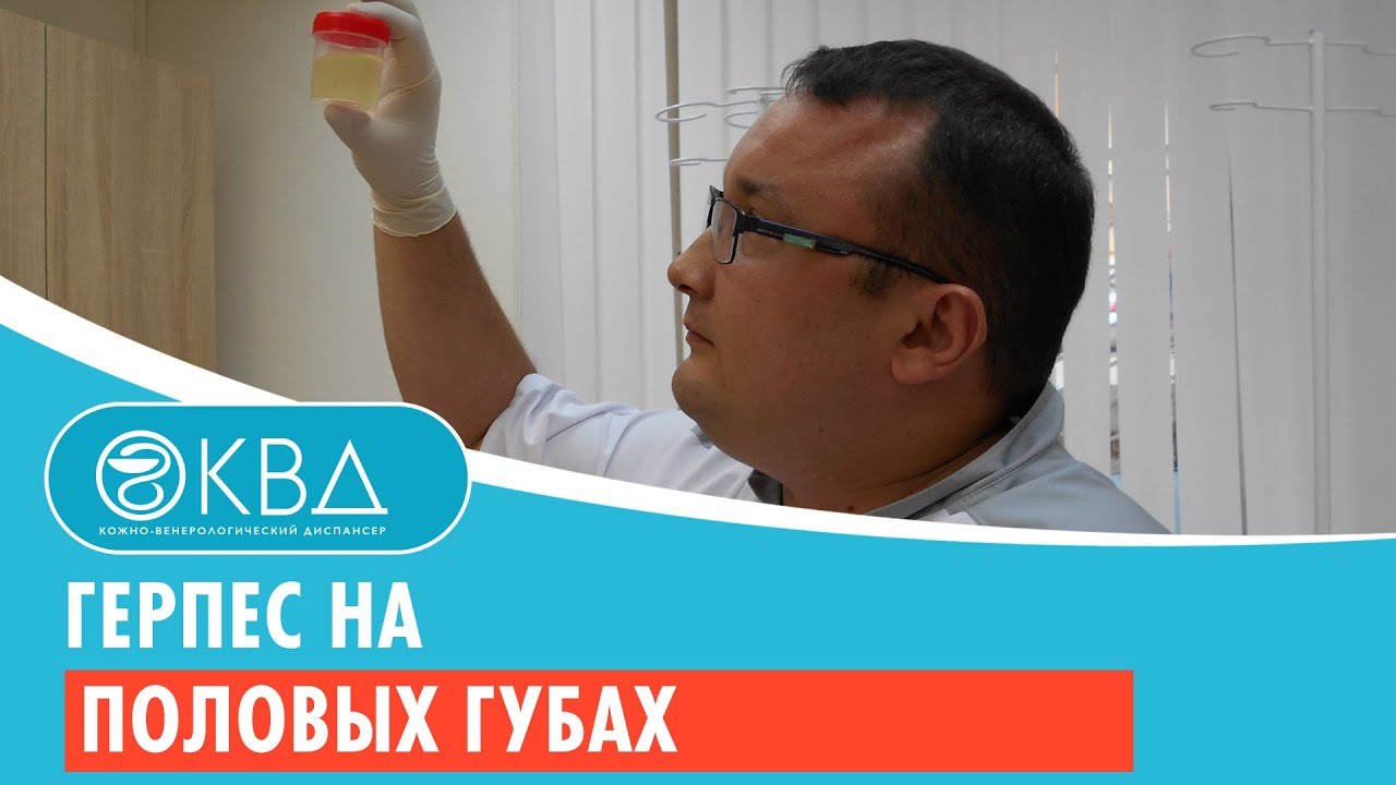 ? Герпес на половых губах. Клинический случай №237