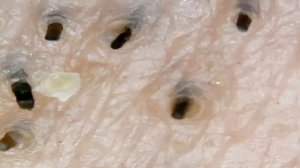 Beard under the microscope (борода под микроскопом)