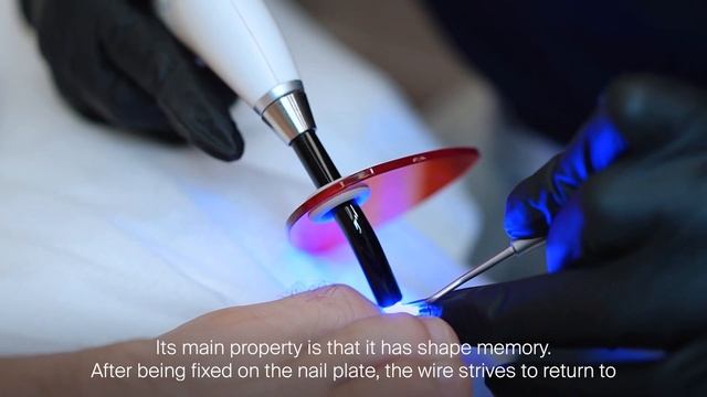 Врослий ніготь | Способи вирішення проблеми смотреть онлайн