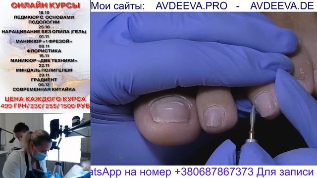 ПЕДИКЮР ОНЛАЙН Виктория Авдеева смотреть онлайн