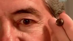 Как делают глазные протезы