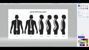Как сделать подушку Мейрама