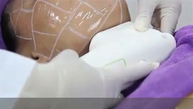 обучение смас для лица смотреть онлайн