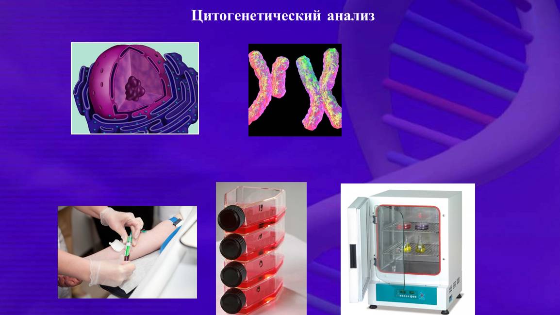 Хромосомные болезни