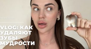 VLOG: КАК УДАЛЯЮТ ЗУБЫ МУДРОСТИ