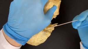 Наружное основание черепа - Basis cranii externa (анатомия человека)