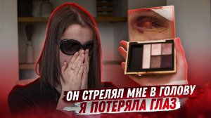 Мой парень выстрелил мне в голову, и я потеряла глаз / Miss X